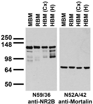 Anti-GluN2B/NR2B Glutamate Receptor Antibody - Image 5