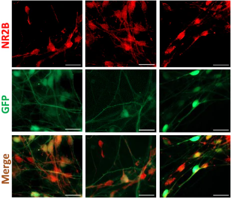 Anti-GluN2B/NR2B Glutamate Receptor Antibody - Image 6