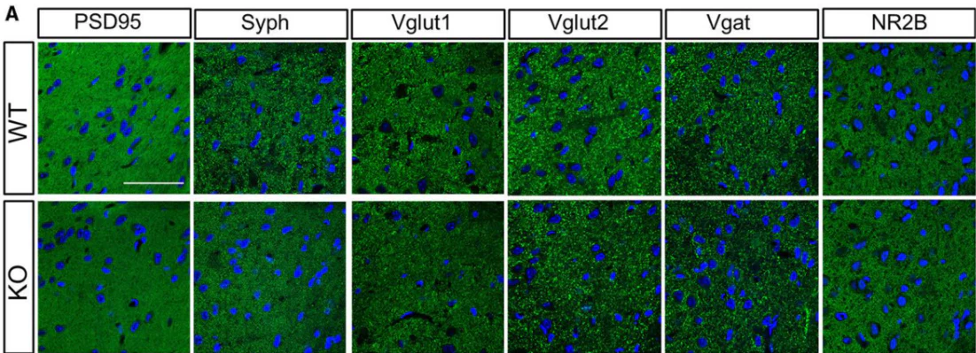 Anti-GluN2B/NR2B Glutamate Receptor Antibody - Image 7