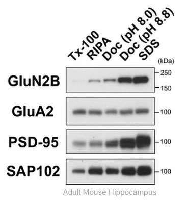 Anti-GluN2B/NR2B Glutamate Receptor Antibody - Image 8