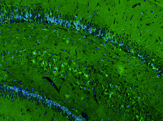 Anti-GluN2B/NR2B Glutamate Receptor Recombinant Chicken Chimeric mAb