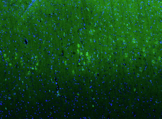 Anti-GluN2B/NR2B Glutamate Receptor Recombinant Chicken Chimeric mAb - Image 3