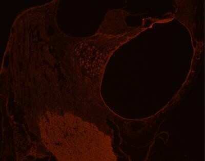 Anti-GLUT10 Antibody