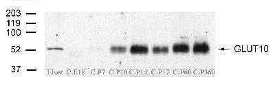 Anti-GLUT10 Antibody - Image 2
