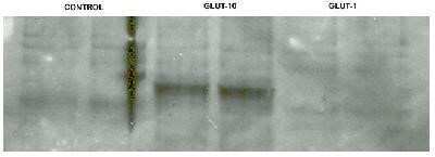 Anti-GLUT10 Antibody - Image 3