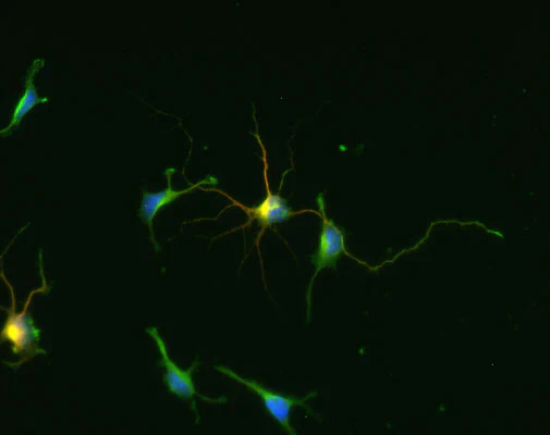 Anti-Glutamic Acid Decarboxylase-67 (GAD 67) Antibody - Image 3