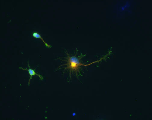 Anti-Glutamic Acid Decarboxylase-67 (GAD 67) Antibody - Image 4