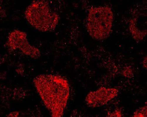 Anti-Glutathione peroxidase 1 (GPx-1) Antibody