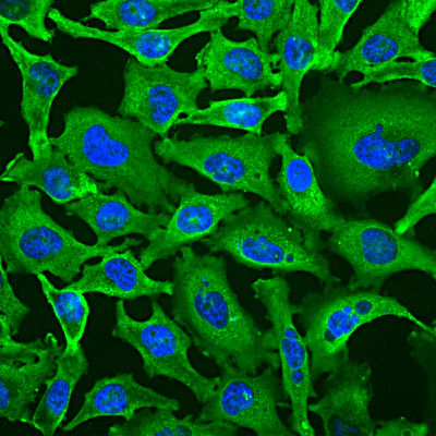 Anti-Glyceraldehyde 3-Phosphate Dehydrogenase Antibody