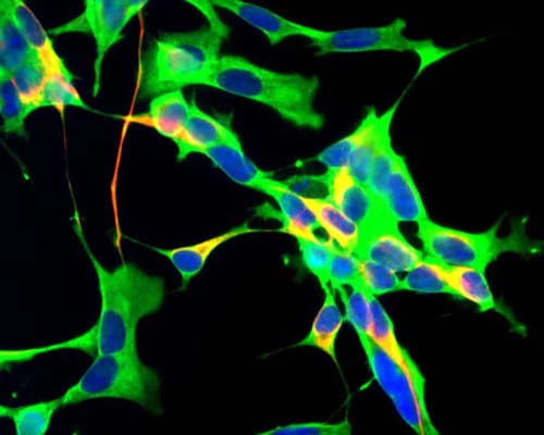 Anti-Glyceraldehyde 3-Phosphate Dehydrogenase (GAPDH) Antibody