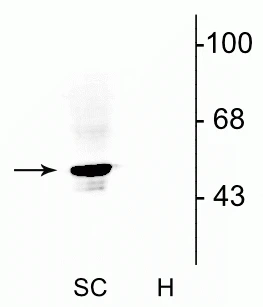 Anti-Glycine Receptor Antibody