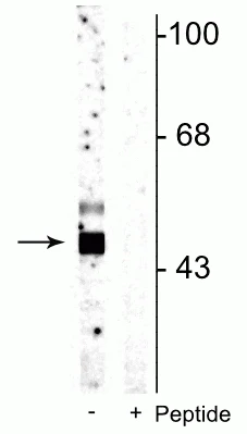 Anti-Glycogen synthase kinase 3 B (GSK3B) (Ser9) Antibody