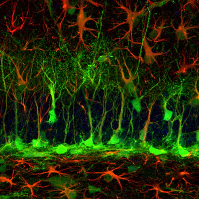 Anti-Green Fluorescent Protein (GFP) Antibody - Image 8
