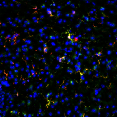 Anti-Green Fluorescent Protein (GFP) Antibody - Image 9