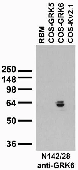 Anti-GRK6A/B Antibody