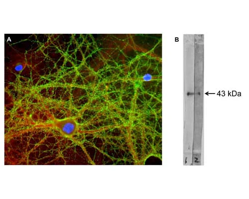 Anti-Growth associated protein 43 (GAP-43) Antibody