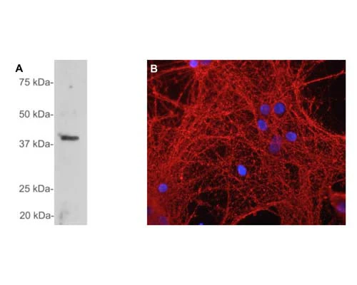 Anti-Growth Associated Protein 43 (GAP-43) Antibody