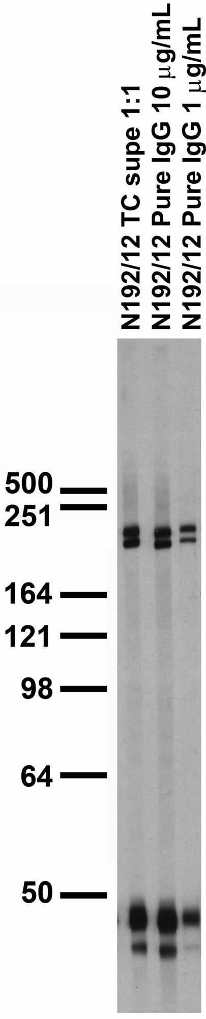 Anti-Gs Protein, Alpha Subunit Antibody