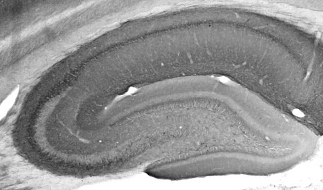 Anti-HCN1 Antibody - Image 3