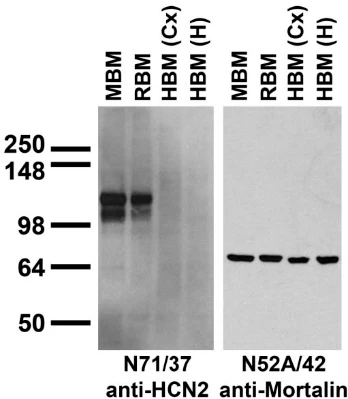 Anti-HCN2 Antibody - Image 2