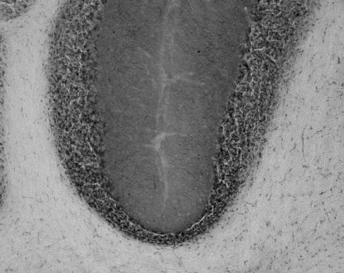 Anti-HCN2 Antibody - Image 3