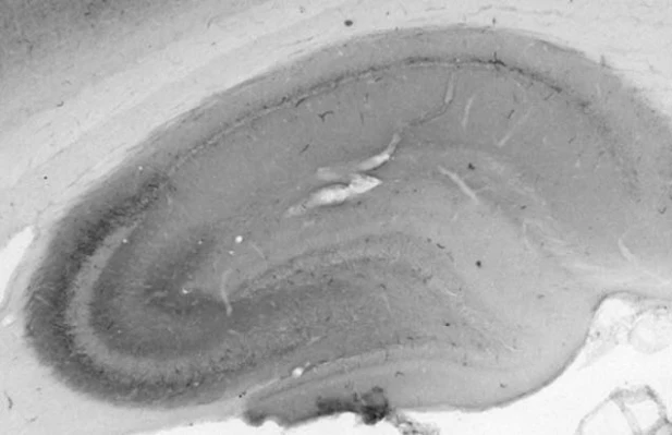 Anti-HCN2 Antibody - Image 4