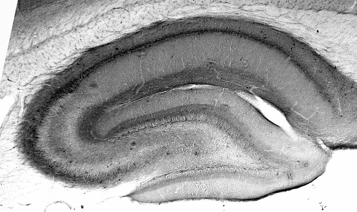 Anti-HCN3 Antibody - Image 2