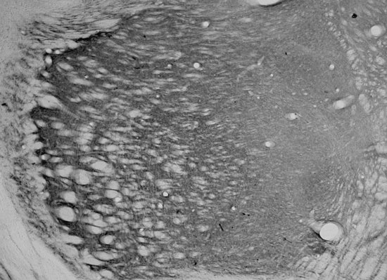 Anti-HCN4 Antibody - Image 2