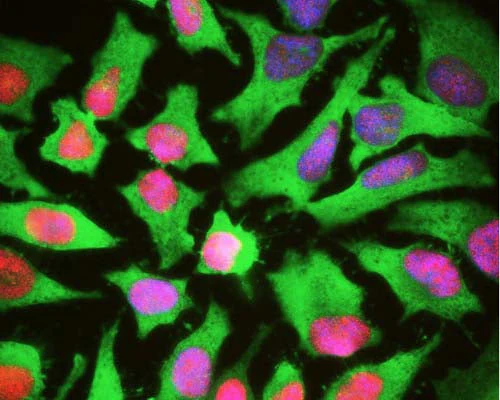 Anti-Heat shock protein 27 (HSP-27) Antibody - Image 2