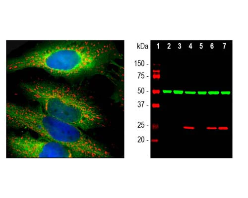 Anti-Heat shock protein 27 (HSP-27) Antibody - Image 3