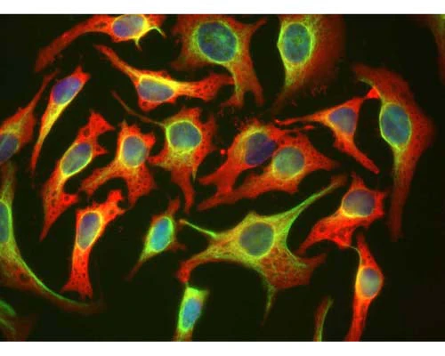 Anti-Heat Shock Protein 27 (HSP-27) Antibody - Image 2