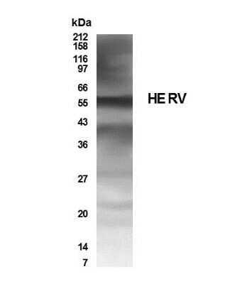 Anti-HERV Antibody