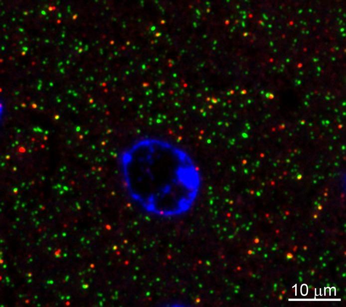 Anti-Homer1 Antibody