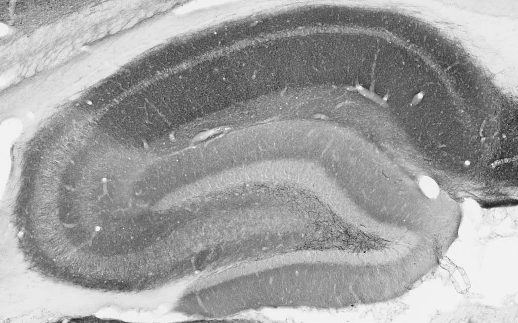 Anti-Homer1 Antibody - Image 2