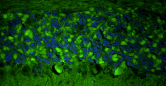 Anti-Homer1 Recombinant Chicken Chimeric mAb - Image 6