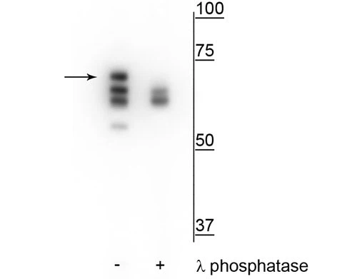 Anti-Hsp70 (Ser153) Antibody