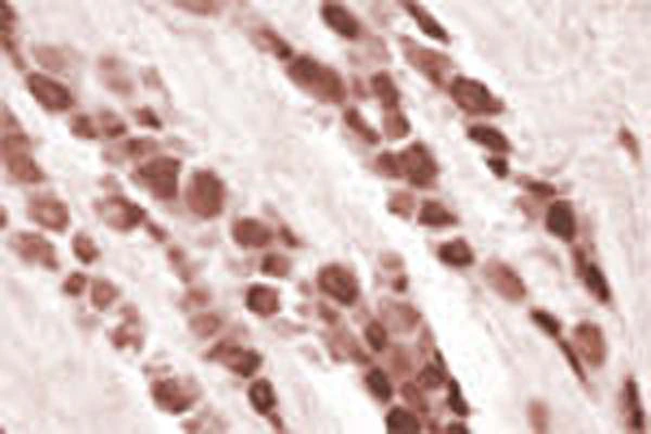 Anti-Huntingtin-associated protein 1 (HAP-1) Antibody
