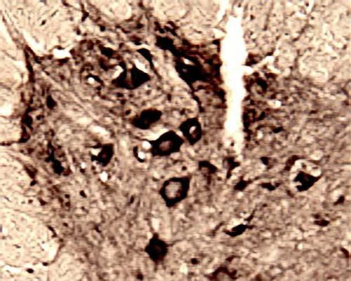 Anti-Huntingtin-associated protein 1 (HAP-1) Antibody - Image 2