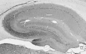 Anti-ICK Antibody