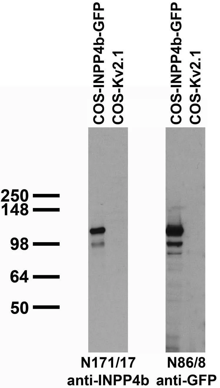 Anti-INPP4b Antibody