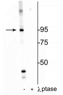 Anti-Insulin Receptor (Thr1160) Antibody