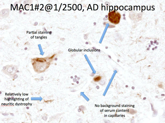 Anti-Integrin alpha-M (CD11b, ΜΑC-1, OX-42 Antigen) Antibody - Image 8