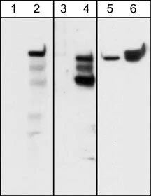 Anti-Integrin β4 (Tyr-1494), Phosphospecific Antibody