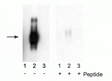 Anti-Interferon-α Receptor, Type I, Subunit I (Ser535,539) Antibody