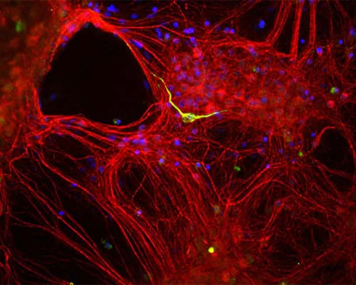 Anti-Internexin alpha (Alpha-Inx) Antibody