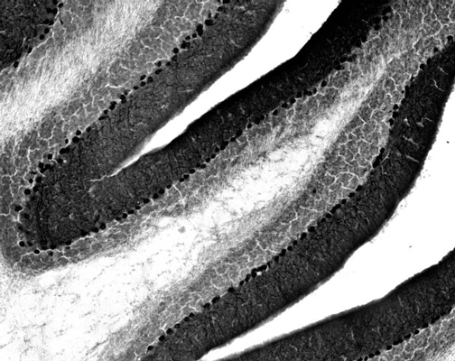 Anti-IP3 Receptor, Type 1 Antibody