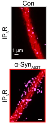 Anti-IP3 Receptor, Type 1 Antibody - Image 4