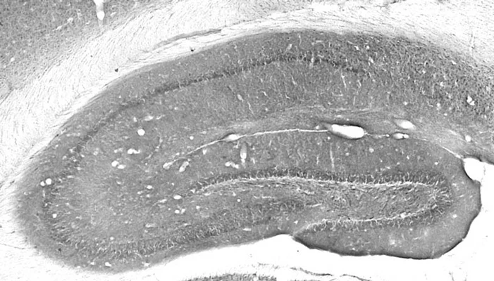 Anti-IP3 Receptor, Type 1 Antibody - Image 7