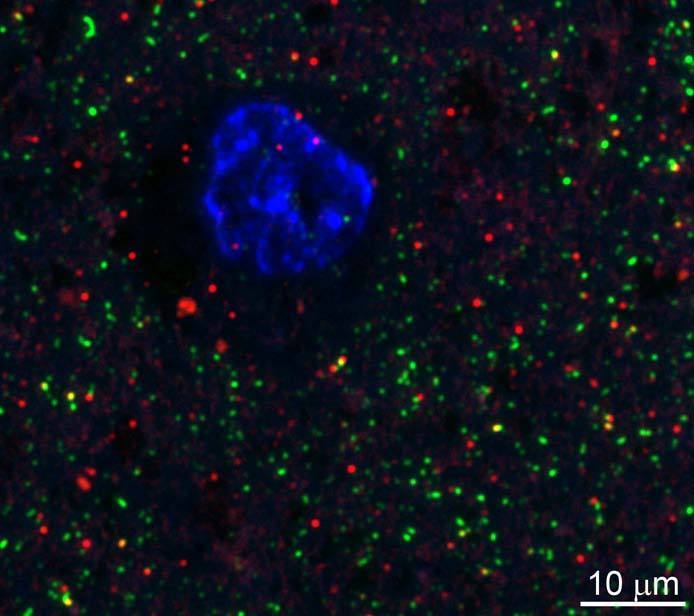 Anti-IRSp53/BAIAP2 Antibody