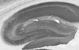 Anti-IRSp53/BAIAP2 Antibody - Image 2